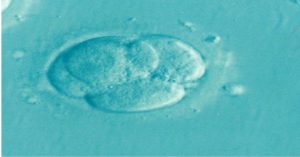 IVF