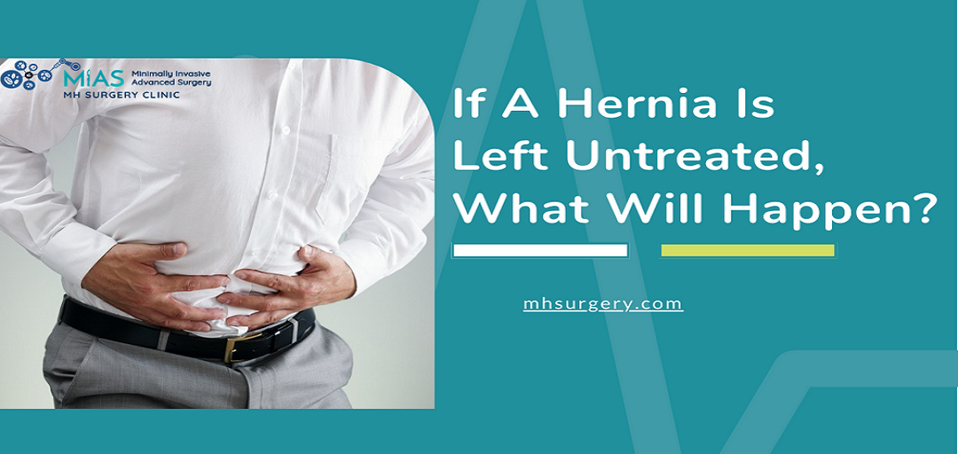 If A Hernia Is Left Untreated, What Will Happen
