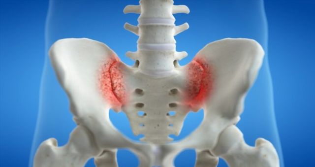 sacroiliac joint